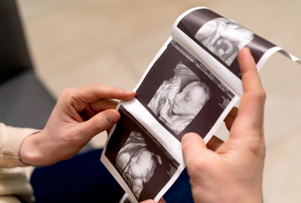 Anomaly Scan at 20 Weeks: What to Expect?