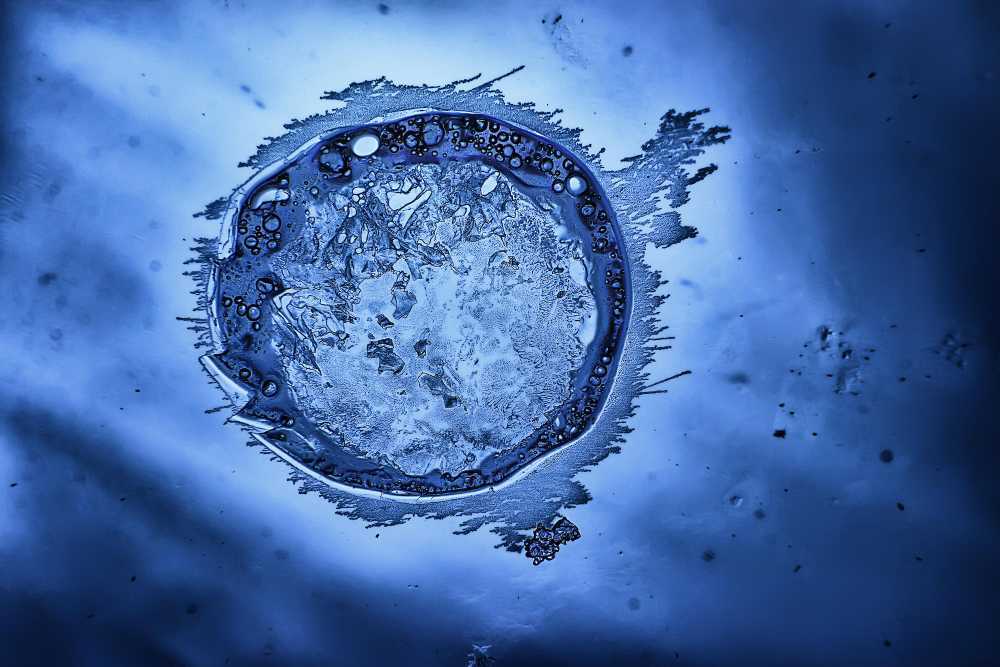 Does Freezing Eggs Stop Periods? Here’s What Happens