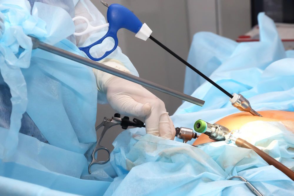 Best Laparoscopic Surgeon in Nepal: Get Details