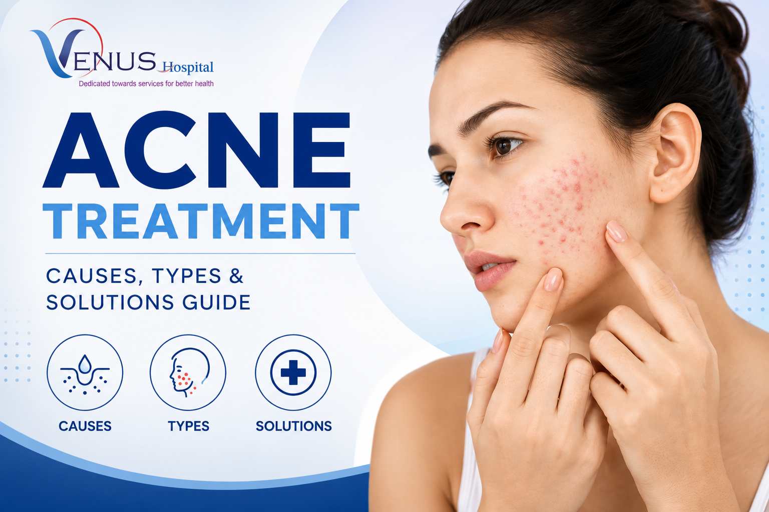 acne treatment at venus hospital