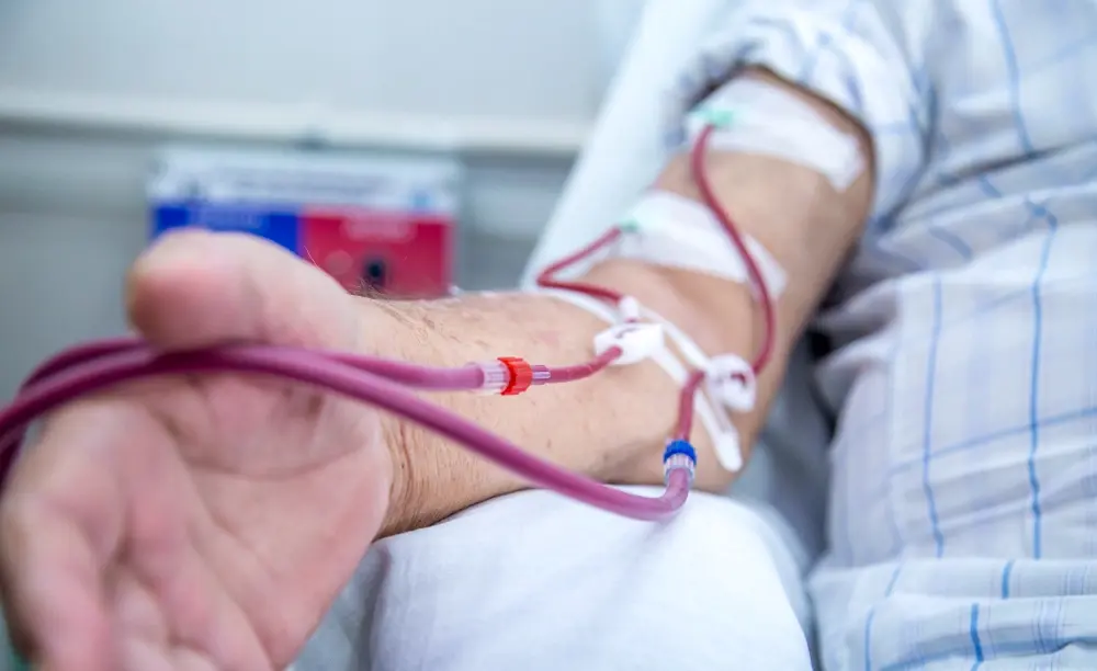 dialysis image