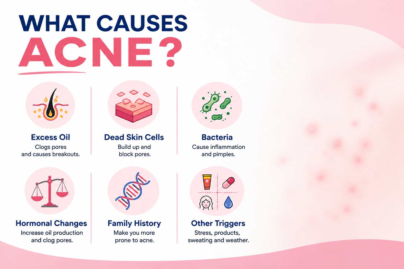 what causes acne