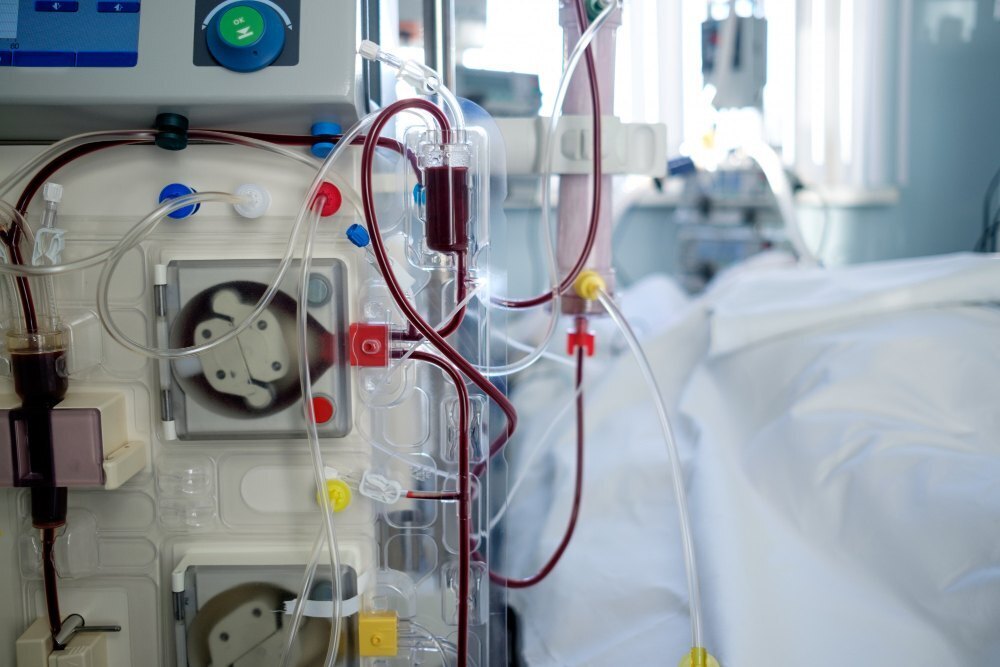 dialysis equipment