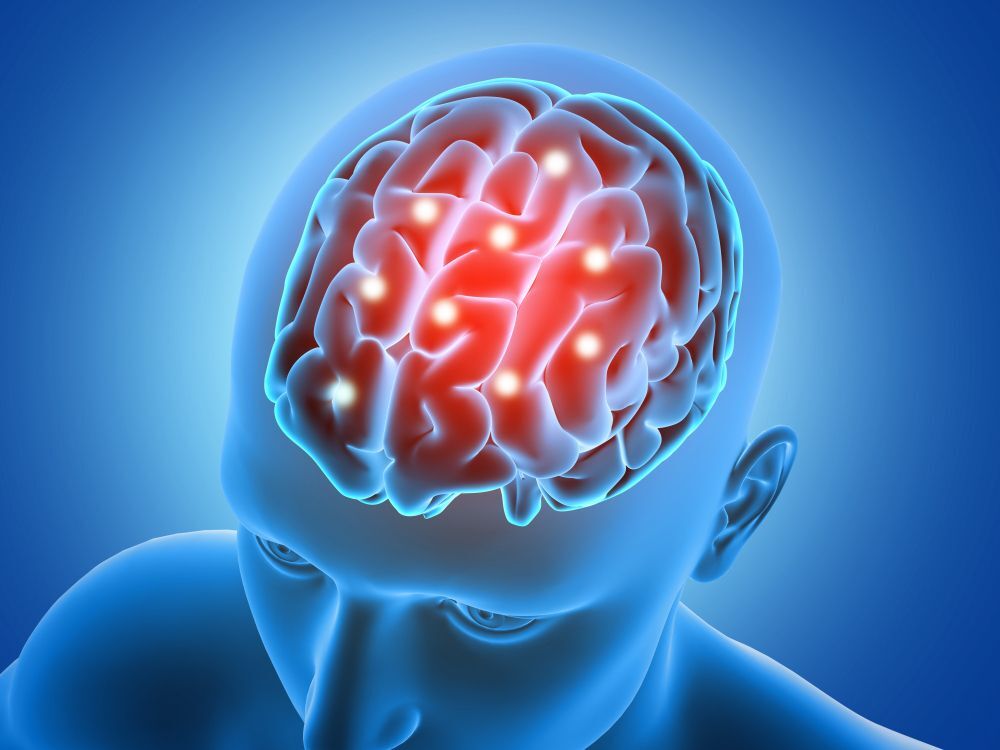 brain-injury
