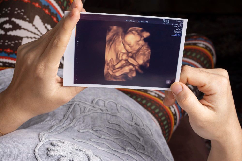 ultrasound-image